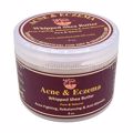 Picture of Acne & Eczema Whipped Shea Butter 8oz by Mine Botanicals
