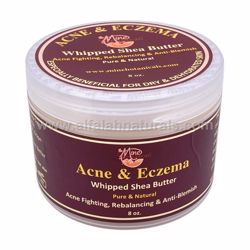 Picture of Acne & Eczema Whipped Shea Butter 8oz by Mine Botanicals